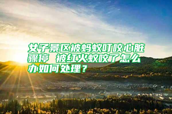 女子景區(qū)被螞蟻叮咬心臟驟停 被紅火蟻咬了怎么辦如何處理？